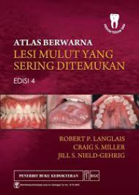 Atlas berwarna: lesi mulut yang sering ditemukan