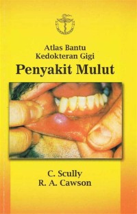 Image of Atlas bantu gigi penyakit mulut