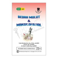 Image of Bedah mulut & maksilofasial