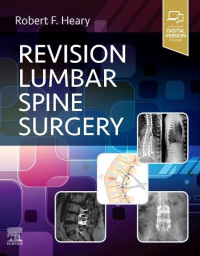 Revision Lumbar Spine Surgery  (Far4)