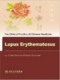 The Clinical Practice of Chinese Medicine Lupus Erythematosus